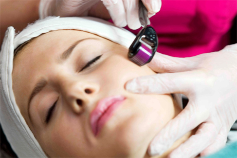 How Much Does Microneedling Collagen-Stimulating Treatment Cost?