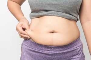 Post-Weight Loss Surgery: What Happens to Your Skin and How Plastic Surgery Can Help